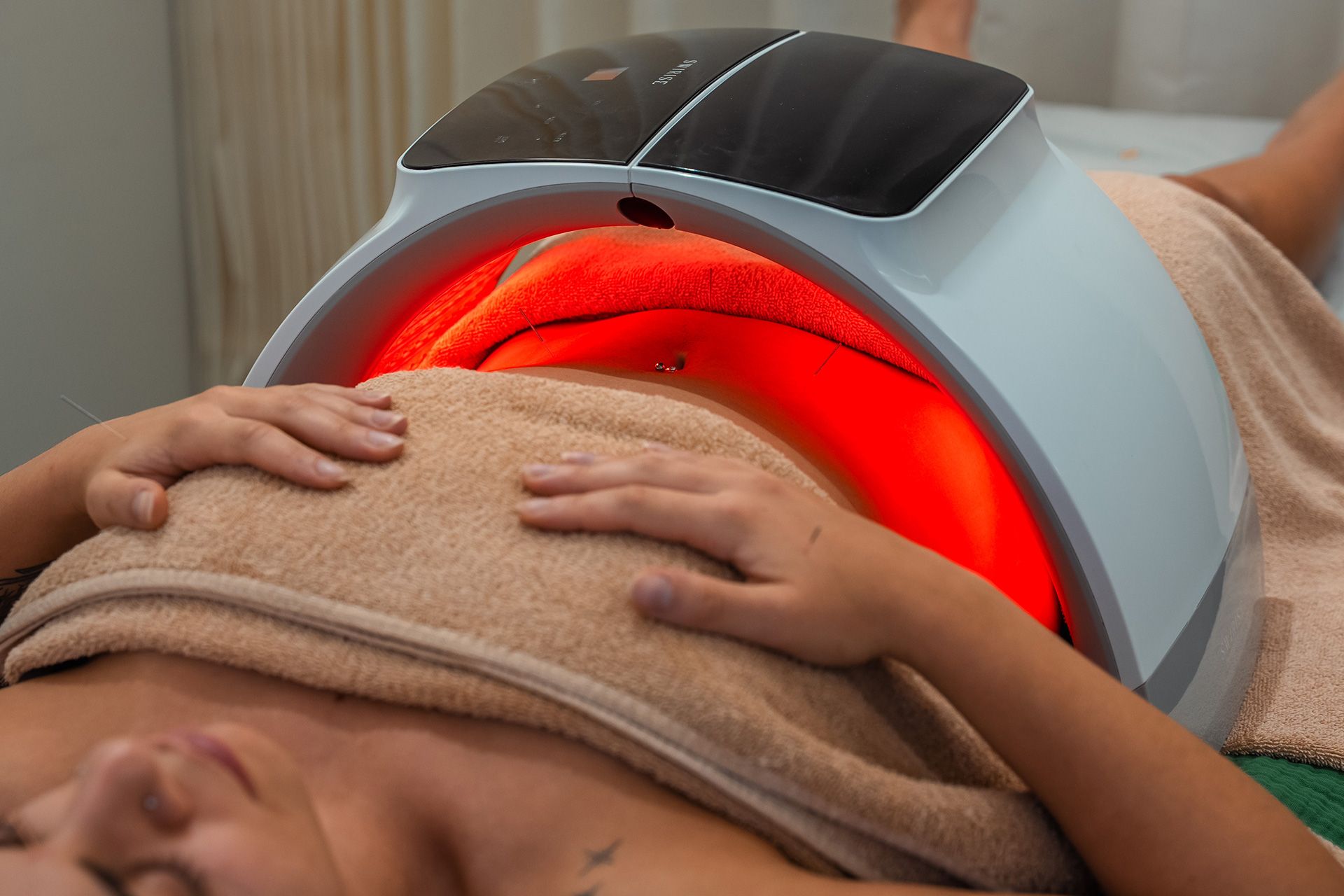 Fertility Acupuncture