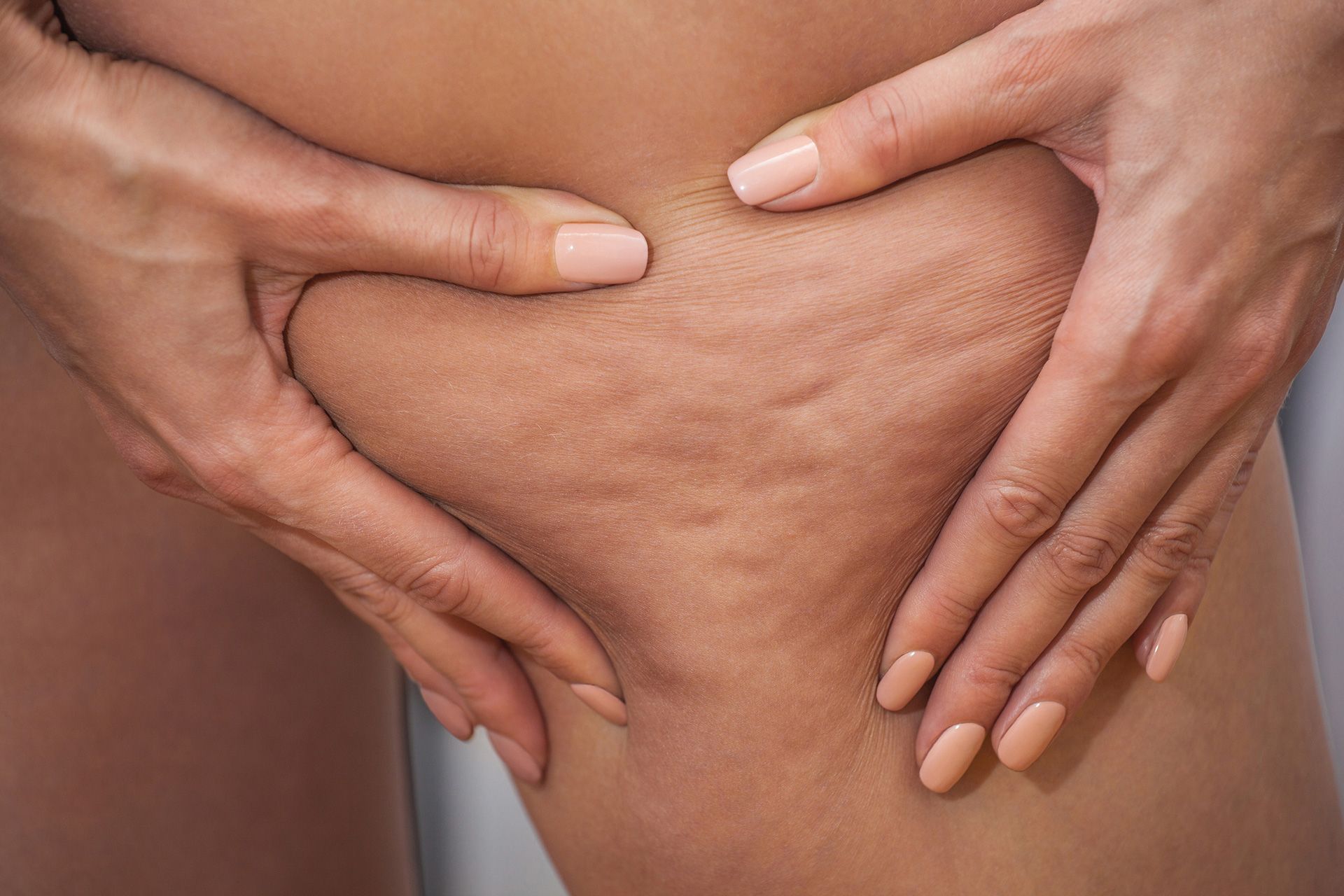 Lipoedema management session at Body Perfected, Marylebone