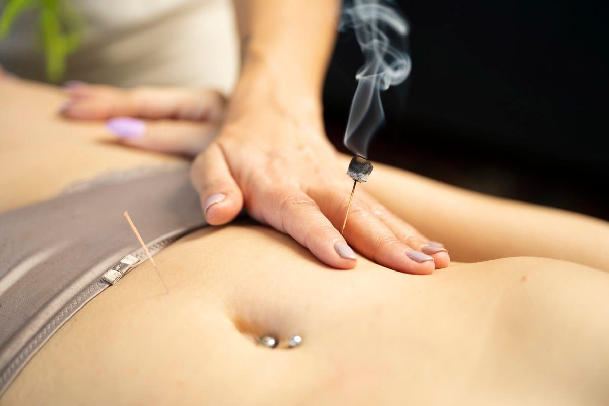 Moxibustion on needle, classical TCM technique, Body Perfected Marylebone
