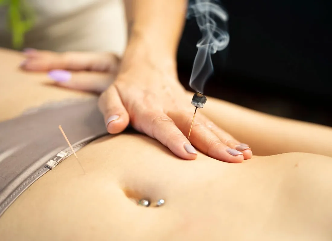 Moxibustion during a Traditional Chinese Medicine session at Body Perfected