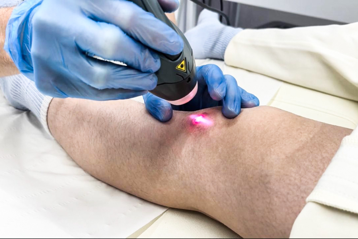 MLS Laser Therapy
