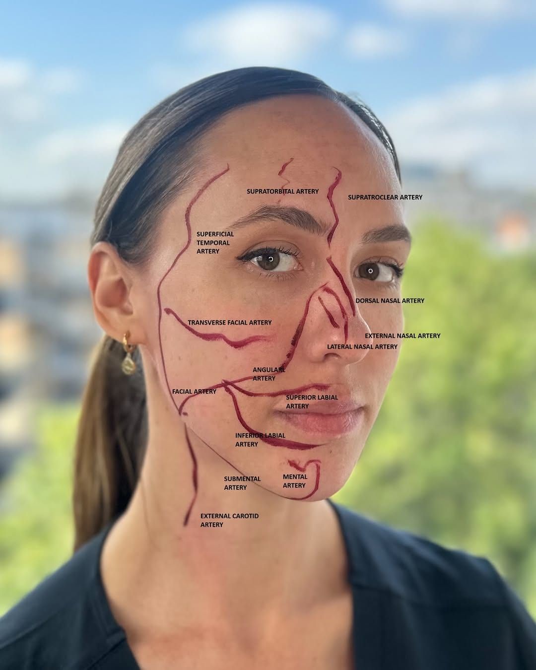 Yesterday we asked you to test your knowledge and name the facial arteries shown