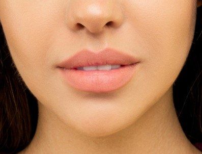 Feminising lip fullness treatment area