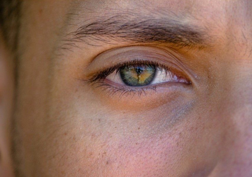 Masculinising brow straightening treatment area