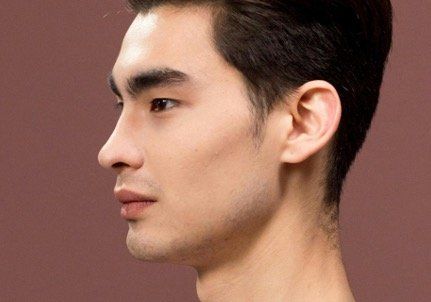 Masculinising cheek contouring treatment area