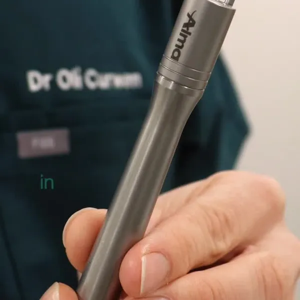 Spider veins gone in minutes — advanced laser, no downtime.