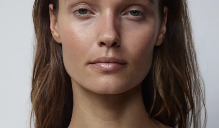 Dermal filler dissolving with hyaluronidase by Dr Paul Elgey at UNTIL Marylebone