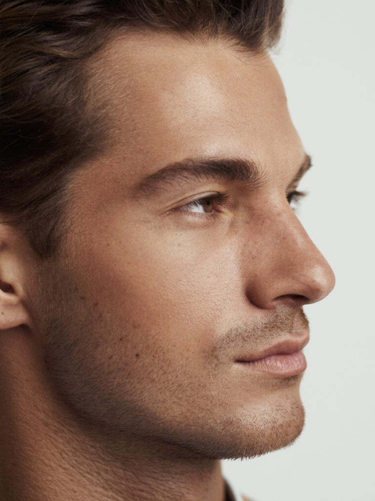 Non-Surgical Rhinoplasty
