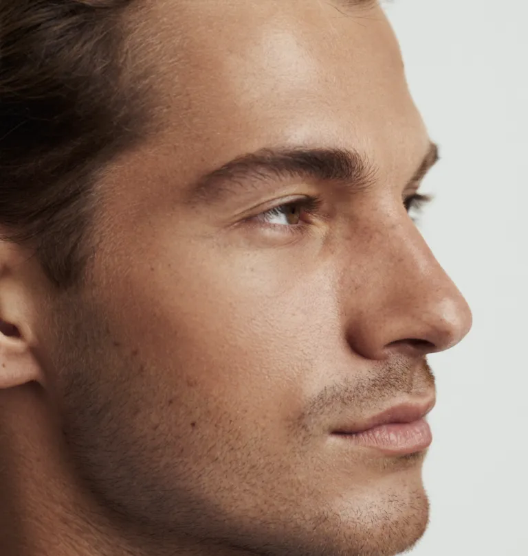 Non-surgical rhinoplasty treatment with Dr Paul Elgey at UNTIL Marylebone, London