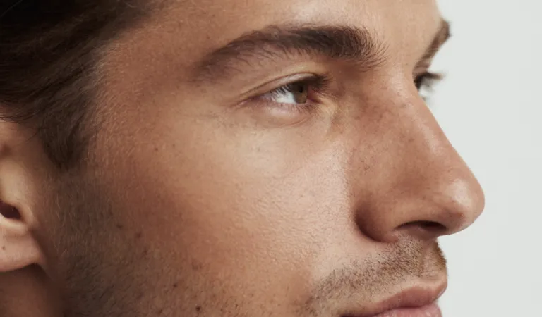 Non-surgical rhinoplasty treatment with Dr Paul Elgey at UNTIL Marylebone, London