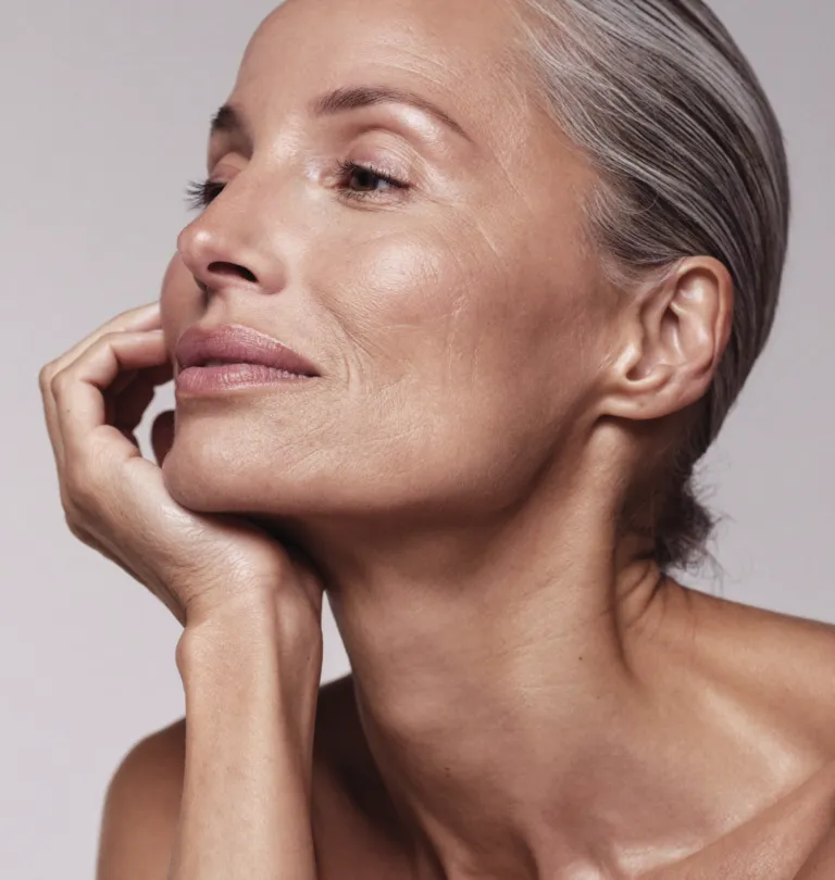 Radiesse collagen-stimulating treatment with Dr Paul Elgey at UNTIL Marylebone