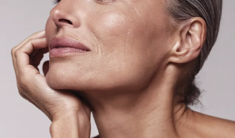 Radiesse collagen-stimulating treatment with Dr Paul Elgey at UNTIL Marylebone