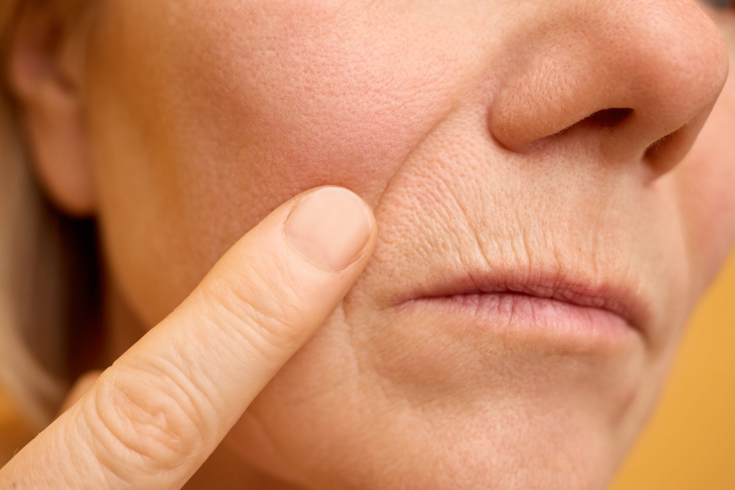 Bioremodelling + Biostimulation — Marylebone