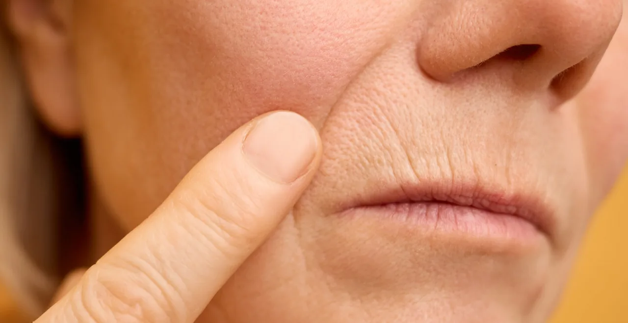 Skin booster and bioremodelling treatment with Dr Paul Elgey at UNTIL Marylebone