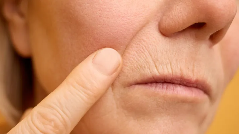 Profhilo and skin-booster bioremodelling treatment with Dr Paul Elgey at UNTIL Marylebone