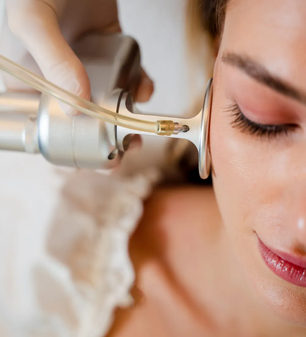 UltraClear laser being delivered along the cheek and jawline