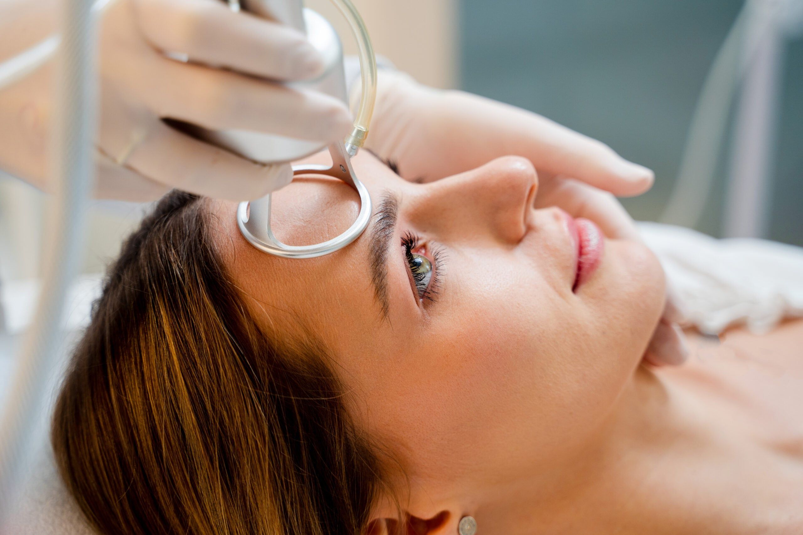 UltraClear laser handpiece treating the forehead during a resurfacing session
