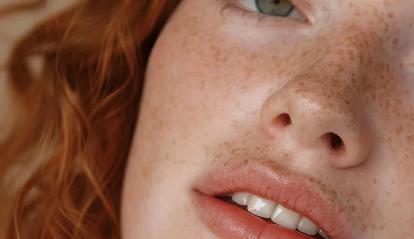 Close view of a mouth and the skin around it