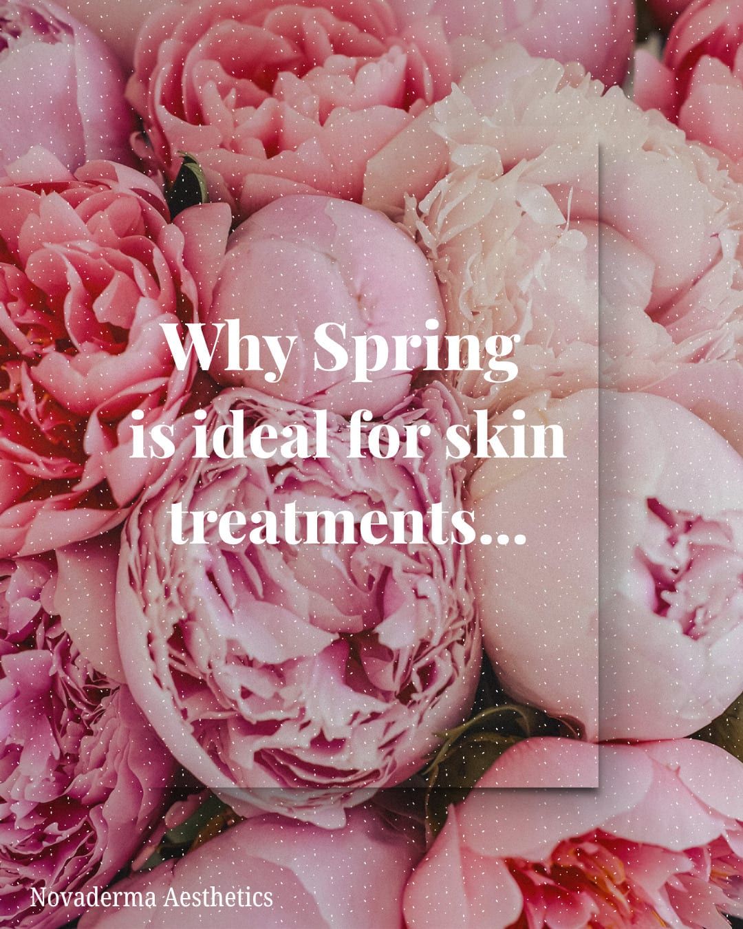 Spring is a good reset for skin that has come through winter dry, dull and sensi