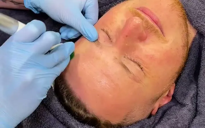 Dull & Dehydrated Skin