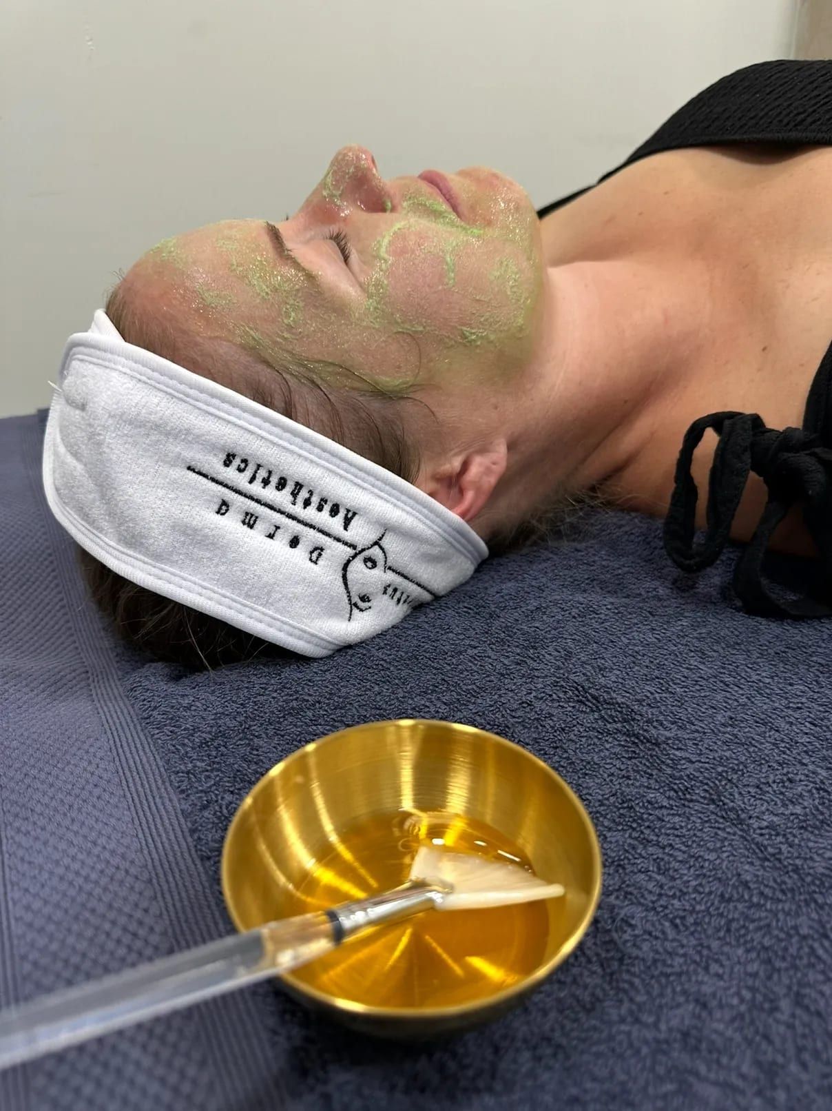 Chemical Peels