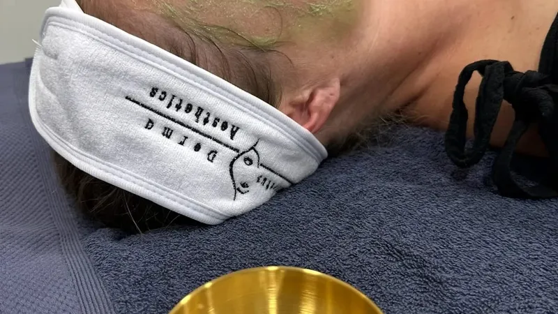 Chemical peel being applied to a patient at Perfectus Derma Aesthetics, UNTIL Soho