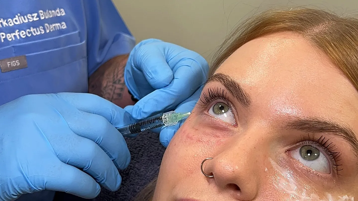 Aesthetic Nurse Practitioner treating the under-eye area with polynucleotides at Perfectus Derma Aesthetics, UNTIL Soho