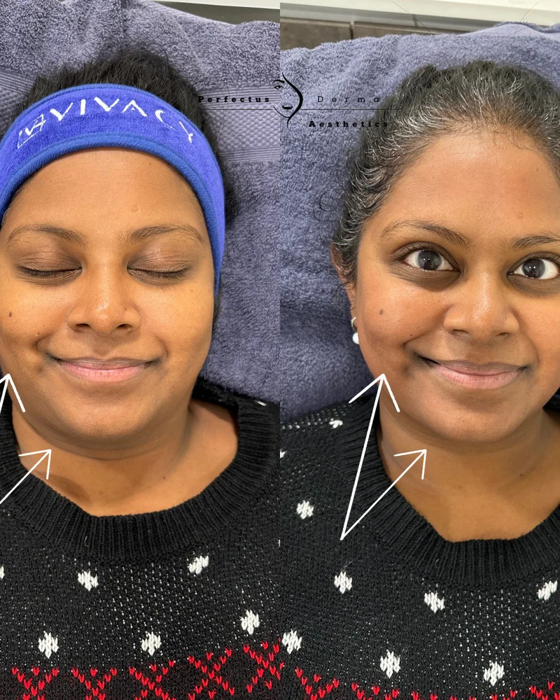 Hydro2Facial: radiance and hydration