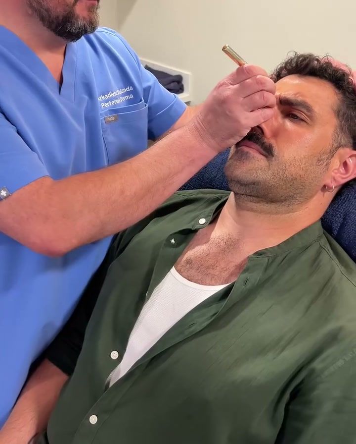 Anti-Wrinkle Injections